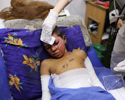 Civilian injuries in Gaza similar to those of soldiers in war zones, study finds