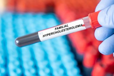 FDA Expands Use Of Regeneron's Evkeeza To Infants With Rare Cholesterol Disorder