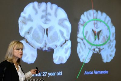 Here's what to know about CTE, the brain disease the NYC shooter blamed for his mental health issues