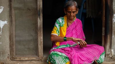Scientists are unraveling the link between pollution and psoriasis