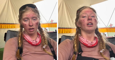 Severely Injured After Everest Climb, 17YO Teen Sparks Online Debate: “Why Take The Risk?”