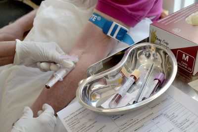 Liver disease breakthrough as scientists can now work out person’s risk in seconds