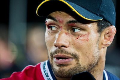 Shane Christie sustained multiple head injuries playing rugby. In death, he is still fighting for change