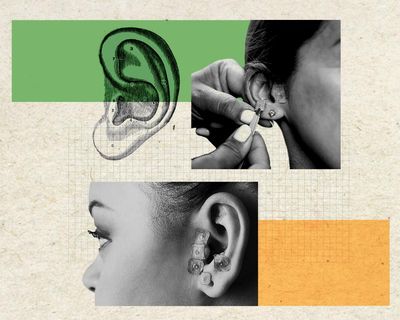 Ear seeding: can an ancient wellness technique really de-puff your face?