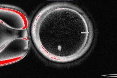 Researchers turn human skin cells into eggs -- but not yet usable ones