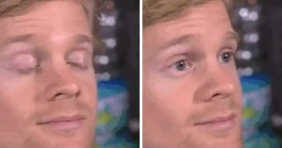 Man Behind “Blinking Guy” GIF Is Unrecognizable 8 Years After Becoming Internet Star