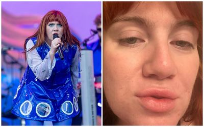 CMAT pulls tonight's Brixton Academy show and rest of UK tour over wisdom tooth emergency