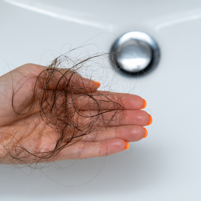 Losing It: The Untold Reality of Living Through Hair Loss