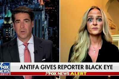 Right-wing journalist tells Fox News an ‘antifa-affiliated’ Portland protester gave her a black eye