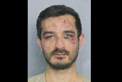 Mugshot shows burglary suspect beaten black and blue after targeting MMA fighter’s Florida home