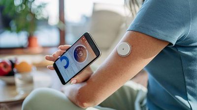 Millions use wearable devices to track their blood sugar. But they don’t help everyone