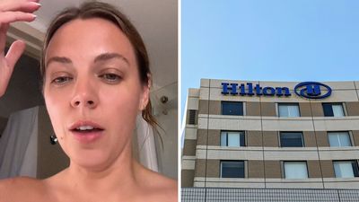 ‘This was the color of my bathing suit‘: Woman stays at Hilton Garden Inn. Then she realizes she’s been soaking in bleach for 45 minutes