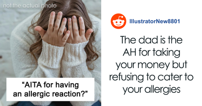 “The Room Exploded”: Teen Tries To Hide Allergic Reaction And It Doesn’t End Well
