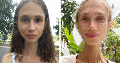 Vegan Woman, 27, Found Lifeless In Hotel Room After Adopting New Raw Diet