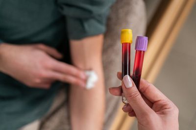 Donors with these blood types are being urged to give blood
