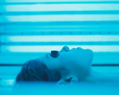 The Guardian view on calls to ban sunbeds: prevention in healthcare raises hard questions about risks