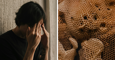 Trypophobia Explained: Why Your Brain Reacts To Tiny Holes