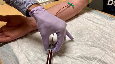 Several Turkish celebrities summoned by authorities for blood tests in drugs probe