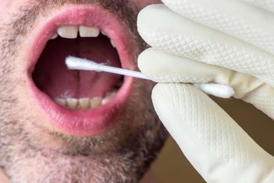 Cheek swabs to detect mutated genes ‘could become useful cancer prevention tool’