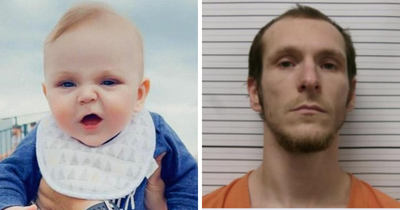 After Pit Bull’s ‘Horror’ Attack On 6-Month-Old Baby, Father Pleads Guilty