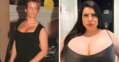 Plastic Surgery Enthusiast Who Paid $148k For 5 BBLs Shocks The Internet With Her ‘Before’ Photos