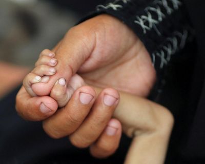 Almost 55,000 preschool children in Gaza acutely malnourished, Lancet study estimates