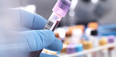 Can a new blood test really detect ME/CFS? An expert unpacks new research