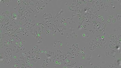 Special protein found in bacteria could cause cancer cells to self-destruct, Spanish scientists say