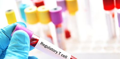 How pollution and the microbiome interact with Tregs, the immune system regulators whose discovery was honored with the Nobel Prize