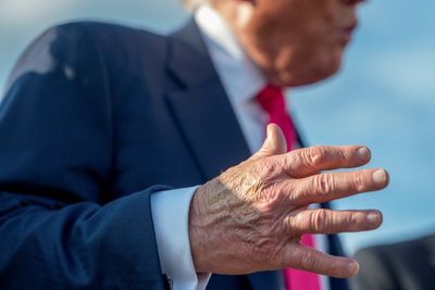 Trump, 79, back at Walter Reed for second physical in a year as health comes under scrutiny