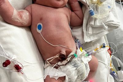 ‘My baby was left with brain damage after he was deprived of oxygen’