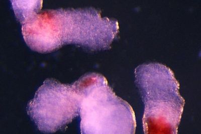 Scientists create lab-grown human embryo model with blood cells