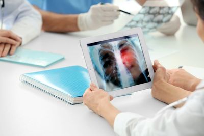 Cullinan Therapeutics Cancer Drug Shows Efficacy In Brain Metastases Among Lung Cancer Patients With Certain Mutations