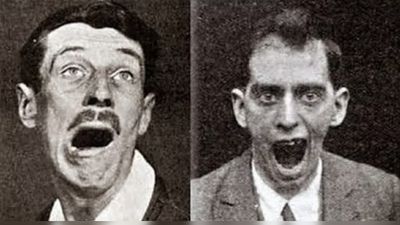 In the early 20th century, thousands found themselves frozen like ‘statues.’ Experts still don’t know what caused it