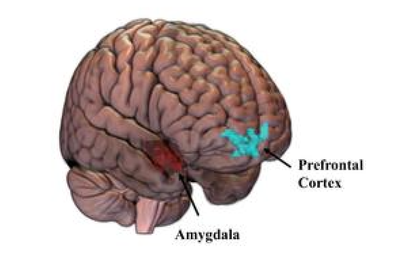 Study finds women’s brains may change after sexual assault