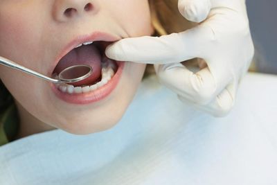 Water fluoridation cut tooth decay in Queensland children, study shows, but most councils have decided against it