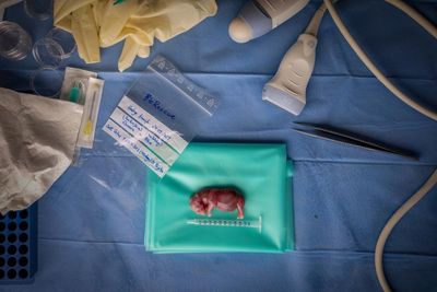 A tiny rhino foetus developed by IVF: Jon A Juárez’s best photograph