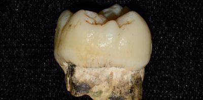 Human ancestors were exposed to lead millions of years ago, and it shaped our evolution