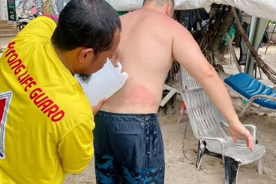 Phuket lifeguards treating many tourists for jellyfish stings