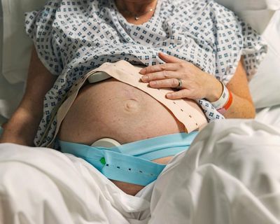 The Guardian view on childbirth and medical negligence: rising payouts highlight the urgency of maternity improvements