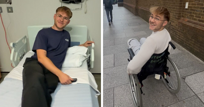 20-Year-Old Decided To Amputate His Leg After Going To A Rock Concert, Breaks His Silence On Why