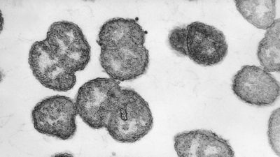 Diagnostic dilemma: A toddler accidently ate gonorrhea bacteria from a lab dish