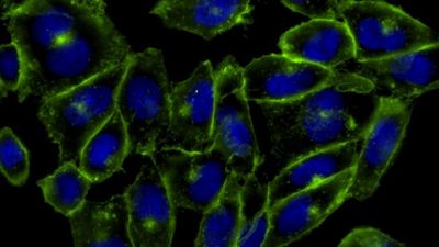 Science history: Scientists use 'click chemistry' to watch molecules in living organisms — Oct. 23, 2007