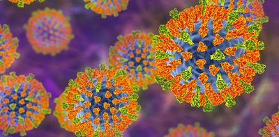 NZ may be on the cusp of another measles outbreak – what happened in 2019 should be a warning