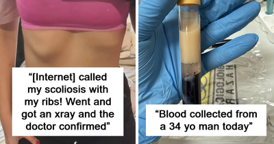 42 Of The Most Bizarre And Unsettling Medical Posts Shared Online