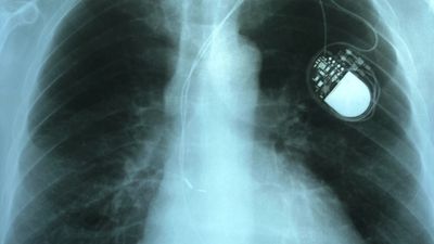 7 Medical Devices Recalled Without Any Public Warning