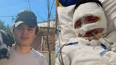 “It’s a Nightmare” Family of Teen Set on Fire Speaks Out About His Horrific Injuries
