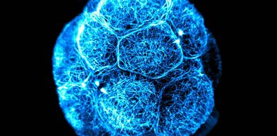 Stem cells sound magical, but they’re not all created equal. Here’s what you need to know