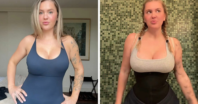 Mom Who Got Her Ribs Broken To Make Waist ‘Smaller’ Reveals Transformation In Before-And-After Clips