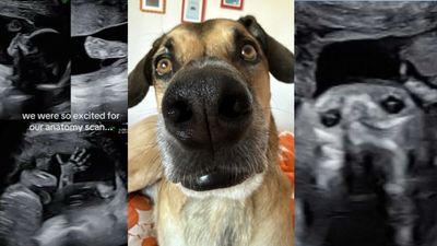 ‘No one can unsee it now’: Pregnant woman posts sonogram on TikTok — only for people to notice it looks exactly like her dog